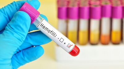 Kalıtsal kan hastalığı: Hemofili