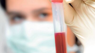 Türkiye'de görülen en yaygın hastalık kansızlık