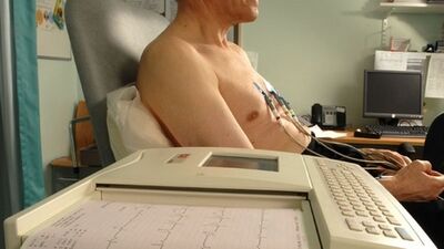 İnme riskini artıran bir ritim bozukluğu: Atriyal fibrilasyon