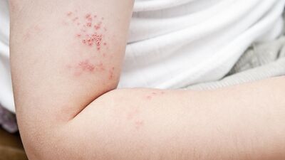 Zonaya dair neler biliyorsunuz?