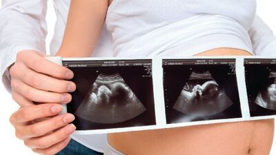 Tüp bebek ile ilgili merak edilenler