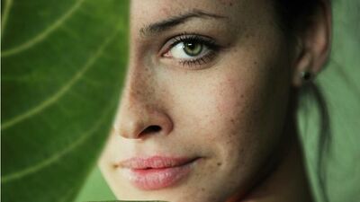 Cilt lekelerinde bitkisel Arbutin mucizesi