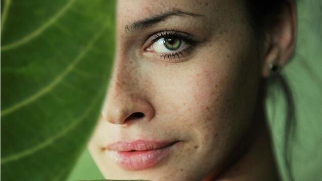 Cilt lekelerinde bitkisel Arbutin mucizesi