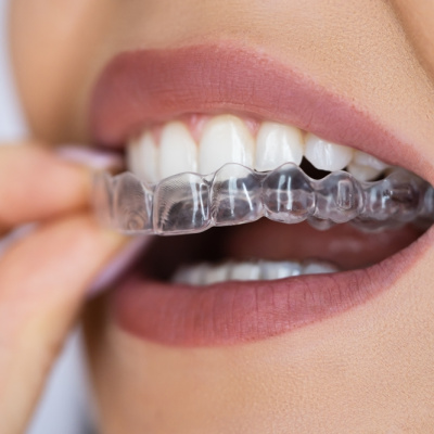 Diş gıcırdatma hakkında her şey!