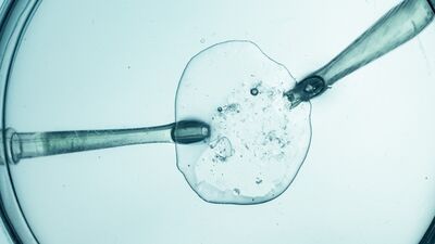 Dünyadan ilginç &#039;yapay döllenme&#039; hikayeleri