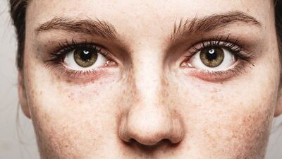 Gözlerinizde acıma, yanma, batma varsa...