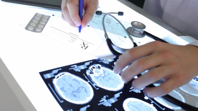 Epilepsi hakkında her şey!