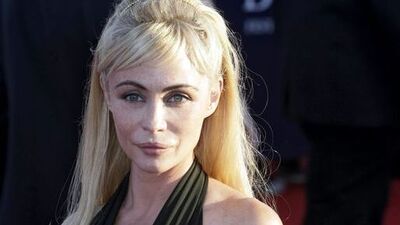 Emmanuelle estetik pişmanı oldu