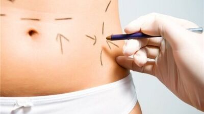 Estetik hakkında merak ettiğiniz her şey!