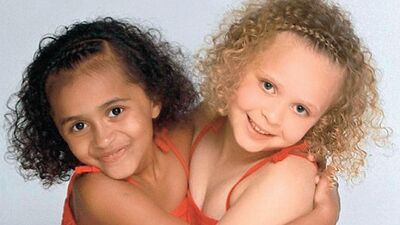 Siyah beyaz ikizler 7 yaşında