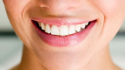 Gülüş estetiğinde doğal mükemmellik