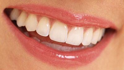 Dişlerinizdeki bozukluk yüz ifadenizi etkiliyor