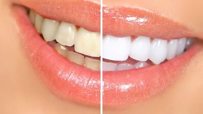 Güzin Kırsaçlıoğlu: Dişler yüzümüzün mücevheridir