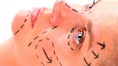 Kök hücre transferi ile protezsiz göğüs büyütme ve yüz gençleştirme tedavileri...