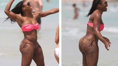 Estetik ameliyat kurbanı olan ünlüler!