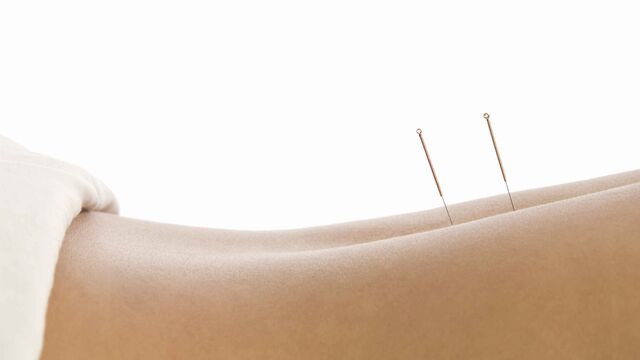 Akupunktur tedavisi orucu bozar mı?