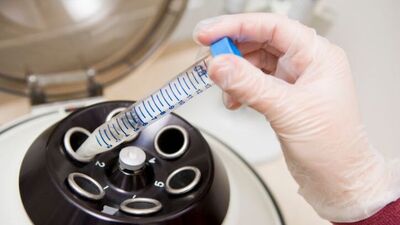 Erkekler için doğum kontrol jeli!