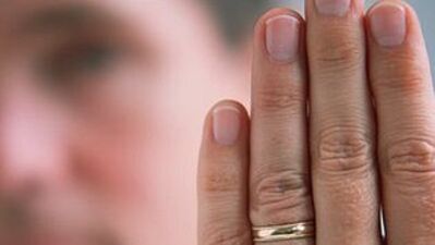 "Kısa parmak" prostatı yeniyor!