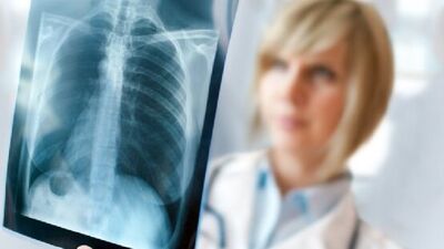 Dikkat bu belirtiler kanser işareti olabilir!