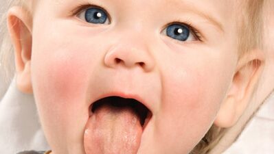 Havaların ani ısınıp soğuması boğaz enfeksiyonuna yol açıyor!