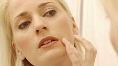 Cilt kanserinin erken teşhisi için benlerinizi takip edin!