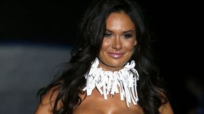 Silvio'nun dişçisi podyumda!