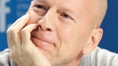 Kel erkekler daha güçlü!