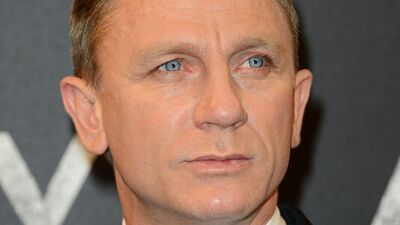 Bond çürük çıktı!