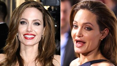 Ünlüler ve dişsiz halleri