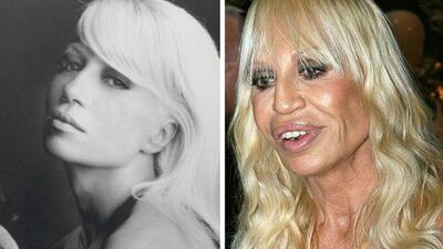 Estetik kurbanı yabancı ünlüler