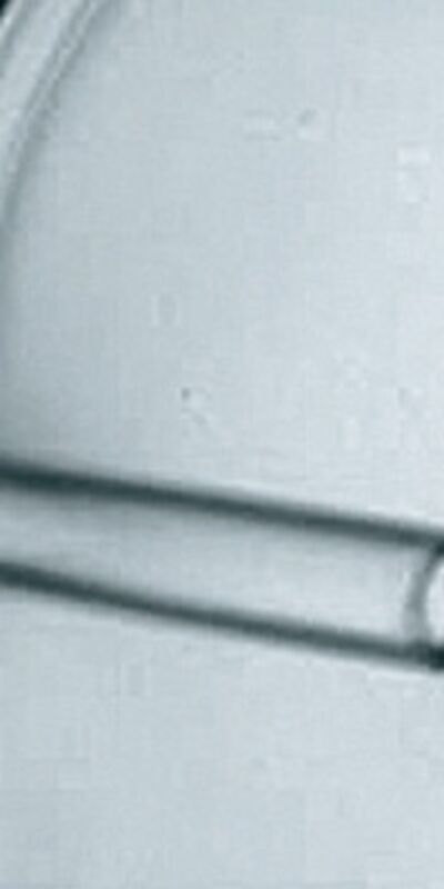 Tüp bebek sürecinde yumurtaların toplanması