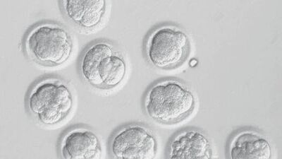 Klon insan kök verdi!