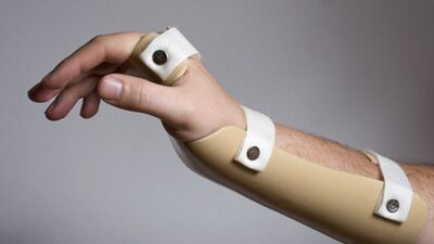 Karpal Tünel Sendromu'na dair merak edilenler