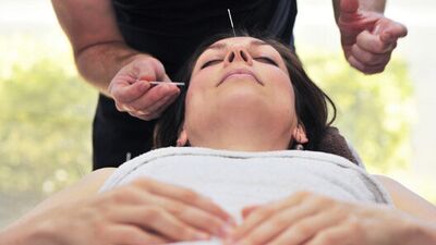 Hamilelikte mide bulantısı için akupunktur