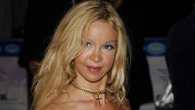 Estetiğe 4.3 milyon harcadı