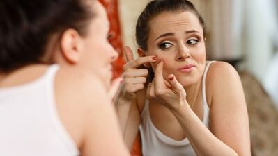 Sivilce deyip geçmeyin!