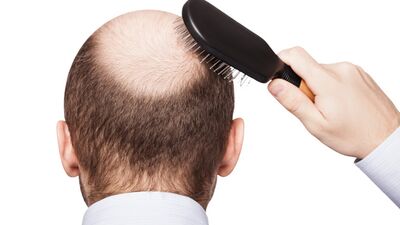 İktidarsızlık mı? Kellik mi?