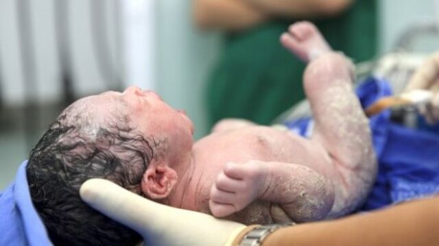 Göbek bağının hemen kesilmesi demir eksikliği sebebi!