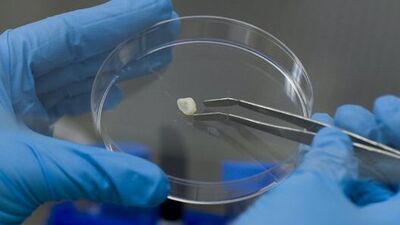 Kaybedilen dişlerin yerine getirilmesi artık mümkün!