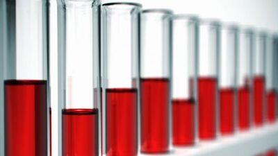 AIDS psikolojik olarak da zarar veriyor