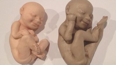 Ultrason görüntüsünden 3 boyutlu bebekler