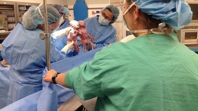 İkizlerden hayata el ele 'Merhaba'