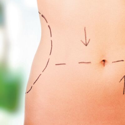 Doğum sonrası estetik