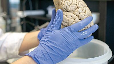 Acı anıları hafızadan silmek mümkün mü?