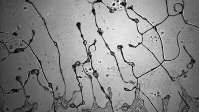 Gözyaşının her hali