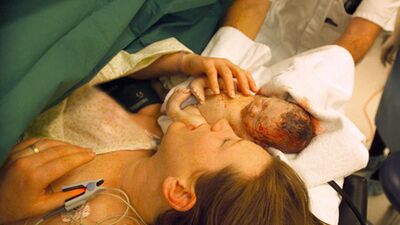 Sezaryen hakkındaki 11 gerçek