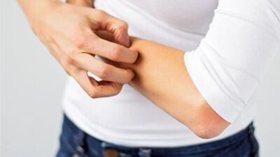 Sivrisineklerden korunmak için doğal yöntemler...