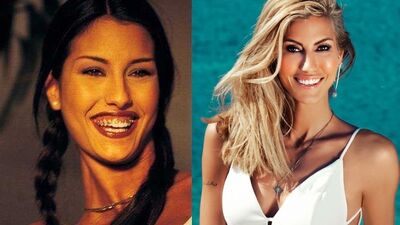 Diş teli takan ünlülerin eski ve yeni halleri