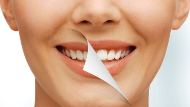 Diş sağlığında doğru bilinen 10 yanlış