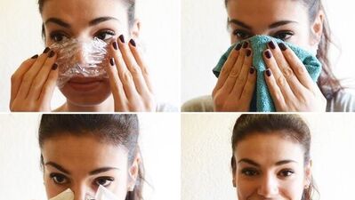 Siyah noktalara da vazelin!